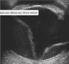 <p>Que parte es y si ves alguna patología</p>