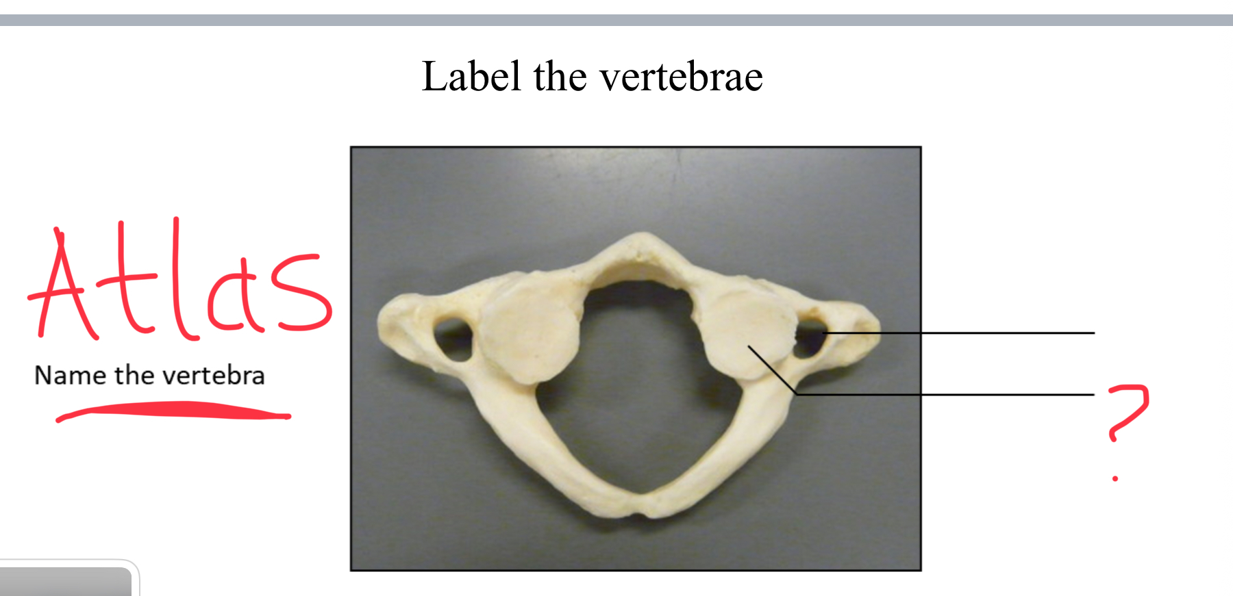 <p>superior articular facet</p>