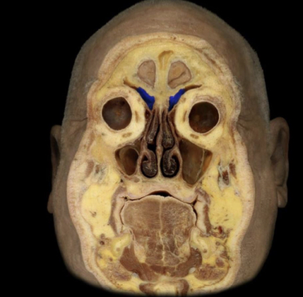 What structure is highlighted in blue?