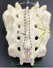 <p>Identify the structure labeled F. </p>