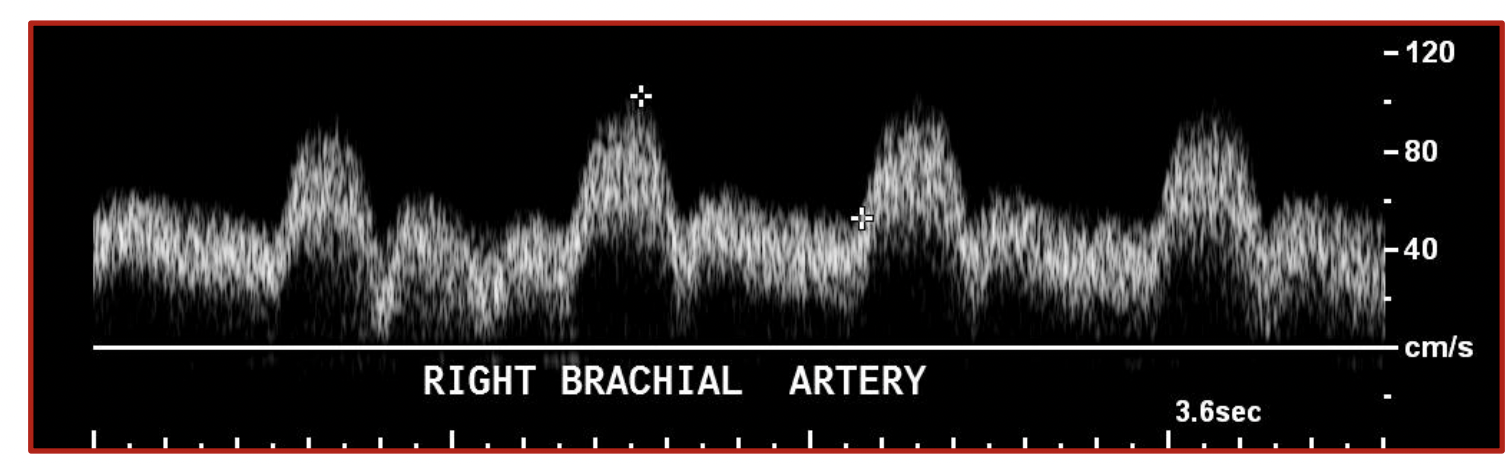 <p>What does this waveform suggest</p>