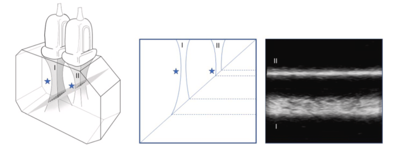 <p><strong>What is slice thickness ( elevation resolution) measurement in ultrasound and how is it determined</strong></p>
