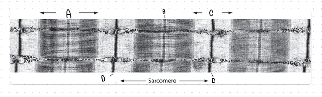<p>Name the structure labeled B in this image:</p>