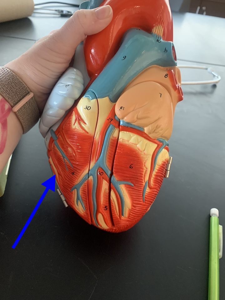 Name the heart structure.