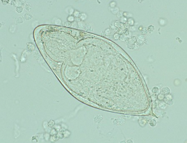 <p>Parasite, lives in bladder</p>