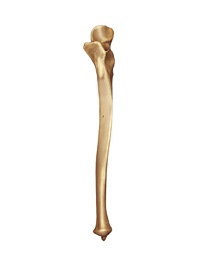 <p>Identify the bone.</p>