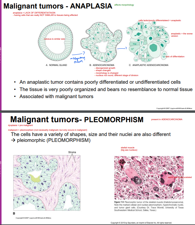 <p><span style="color: yellow"><strong>1) Anaplasia</strong></span> = poorly differentiated (no specific function)<br>- cells NOT SIMILAR to tissue being affected</p><p></p><p><span style="color: yellow"><strong>2) Pleomorphism</strong></span> = variety of shapes, size, nuclei (different size)</p>