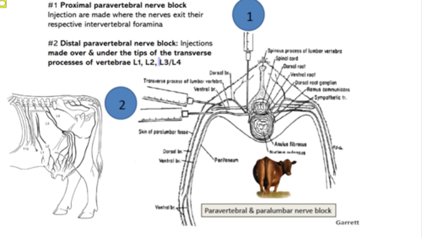 <p>where the nerves exit their respective intervertebral foramina</p>