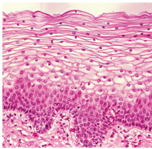 <p><span>Form the covering of all body surfaces, line body cavities and hollow organs, and are the major tissue in glands. They perform a variety of functions that include </span><strong>protection, secretion, absorption, excretion, filtration, diffusion, and sensory reception</strong><span>.</span></p>