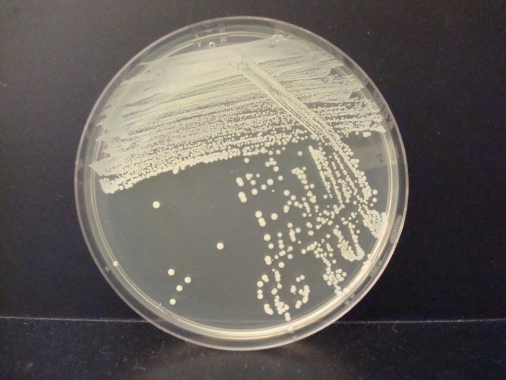 <p>Identify characteristics of the bacteria sample</p>