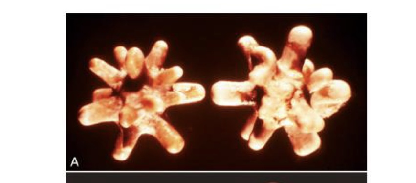 <p>what type of calculi is this?</p>
