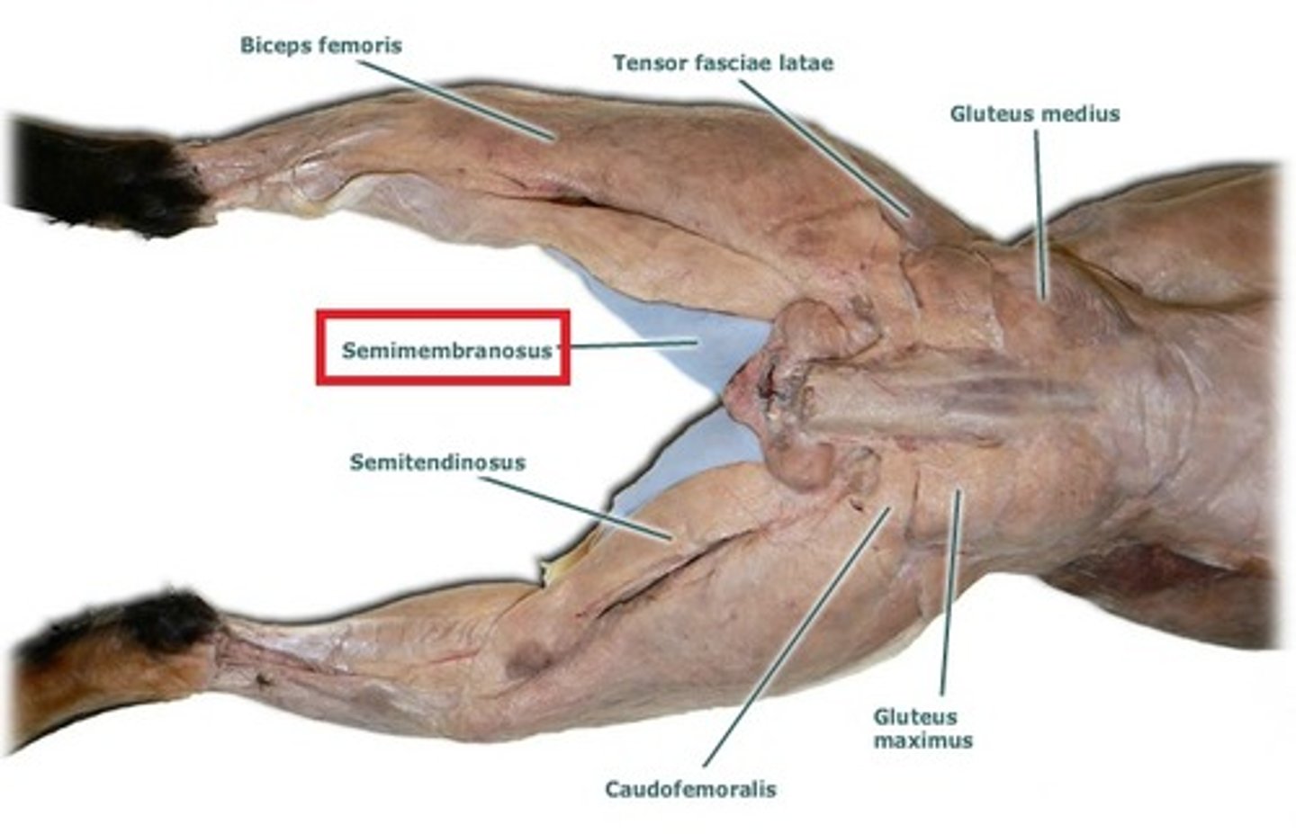 <p>what muscle is highlighted?</p>