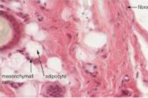 <p>What tissue type is this?</p>