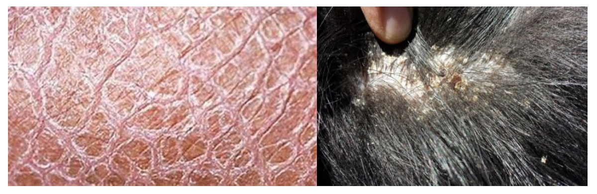 <p>refers to a flat plate of stratum corneum (e.g., Golden Retriever ichthyosis). It is important to distinguish scale versus crust on physical examination.</p>