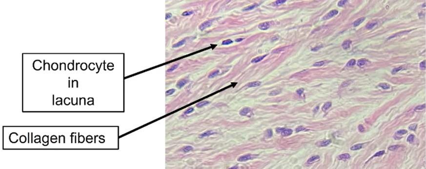 <p>What connective tissue is shown</p>