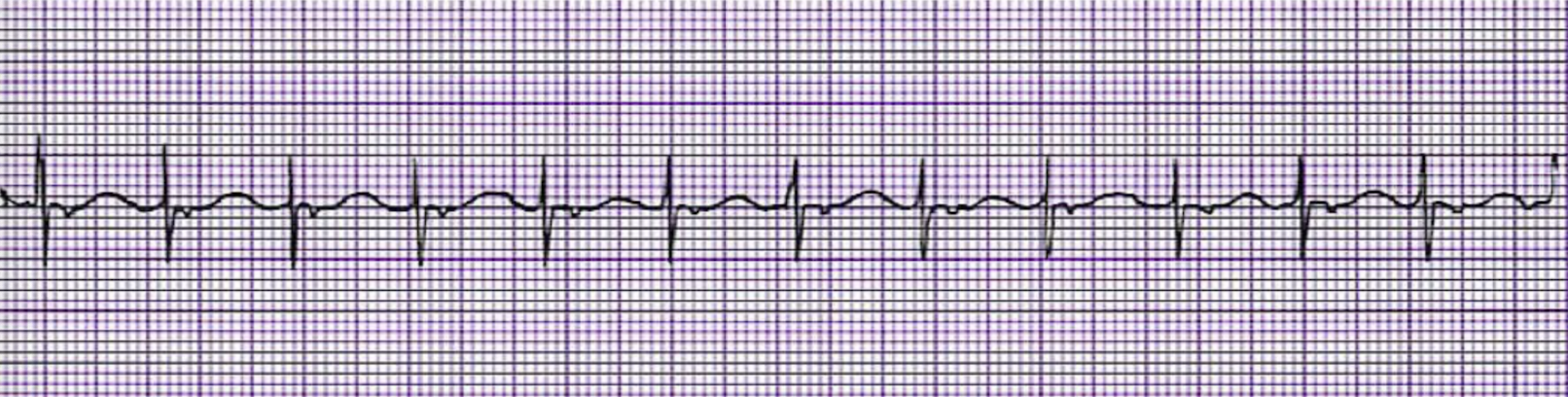 <p>What is this rhythm?</p>