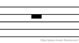 <p>what type of rest is this?</p>