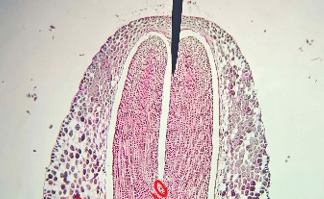 <p>Which structure is being shown?</p>
