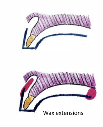 <ol><li><p>Add double layer wax where needed to push the alginate where you need it to go and support floppy alginate when set</p></li><li><p>Aiming to record natural tooth shapes and the supporting bone and the sulcus in that area</p></li><li><p>post damming of the maxillary upper trays is where you add wax posteriorly to prevent excess material on the soft palate area </p></li></ol><p></p>