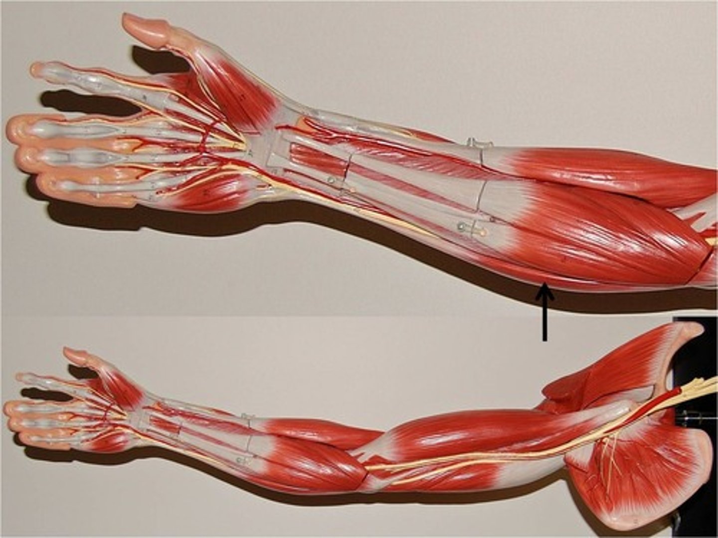 <p>Origin: Lateral epicondyle of humerus</p><p>Insertion: fifth metacarpal</p><p>Action: Extends and adducts hand</p>