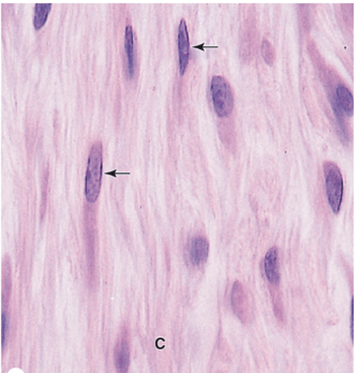 <p>Describe the cytoplasm of active fibroblasts.</p>