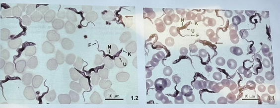 <p>Trypanosoma brucei symptom (1)</p>