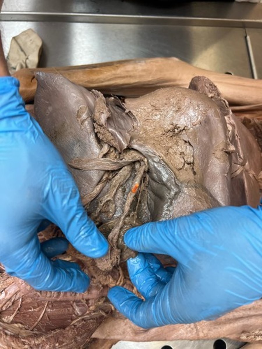 <p>common hepatic duct</p>