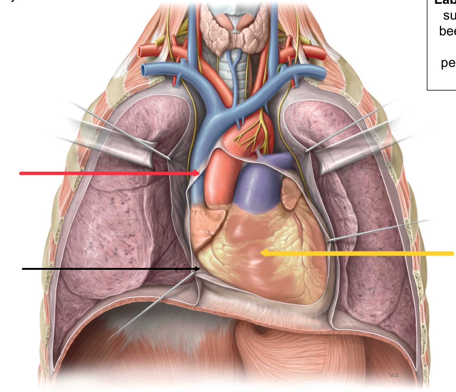 <p>What structure is identified by the red line?</p>