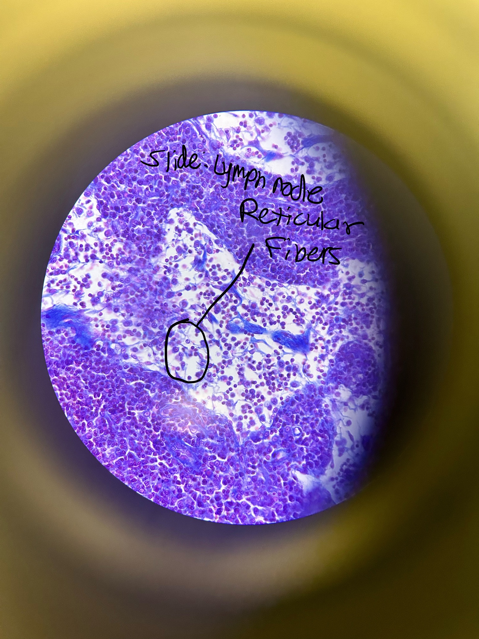 <p>Loose Connective Tissue: Reticular CT Location and Function </p>