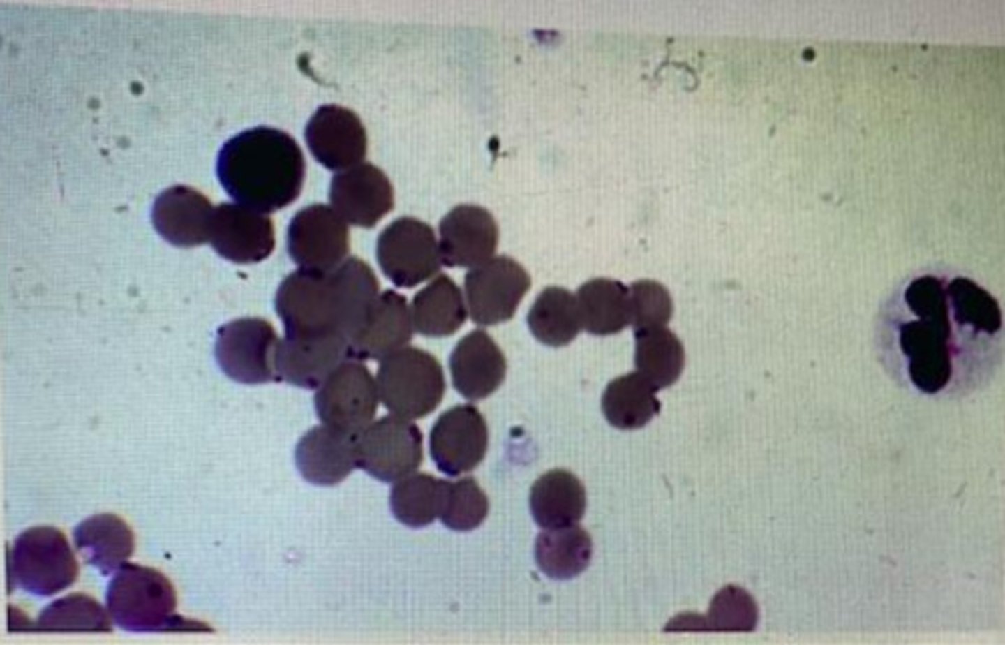 <p>What is the diagnosis of this blood smear from a cat?</p>