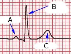 <p>Label these waves on an ECG</p>
