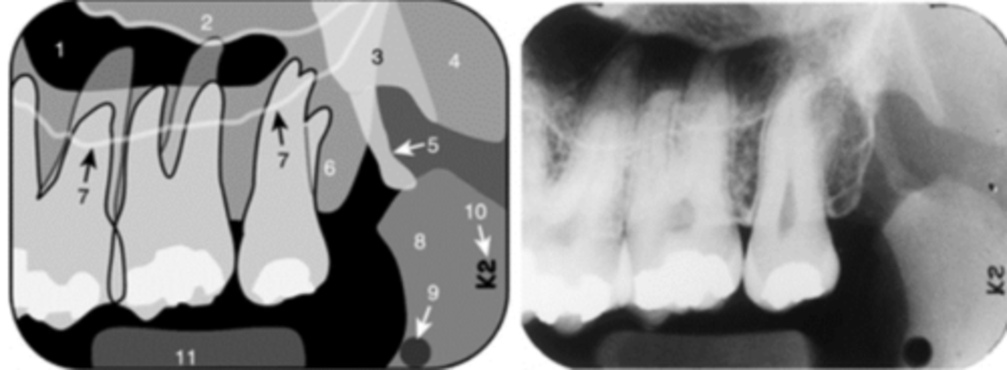 <p>Name the curved, hyperdense line that superimposes the roots of the teeth indicated by #7.</p>