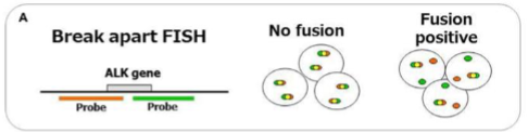 <p>Doesn’t tell you the partner gene but tells you there is a translocation present</p><p>(mechanism in pic)</p>