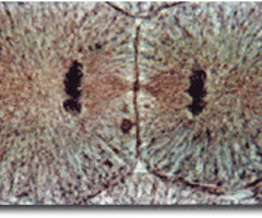 <p>the final phase of cell division in which the chromatids or chromosomes move to opposite ends of the cell and two nuclei are formed</p>