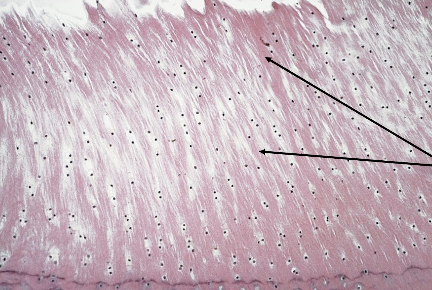 <p>What is the arrow point at?</p>