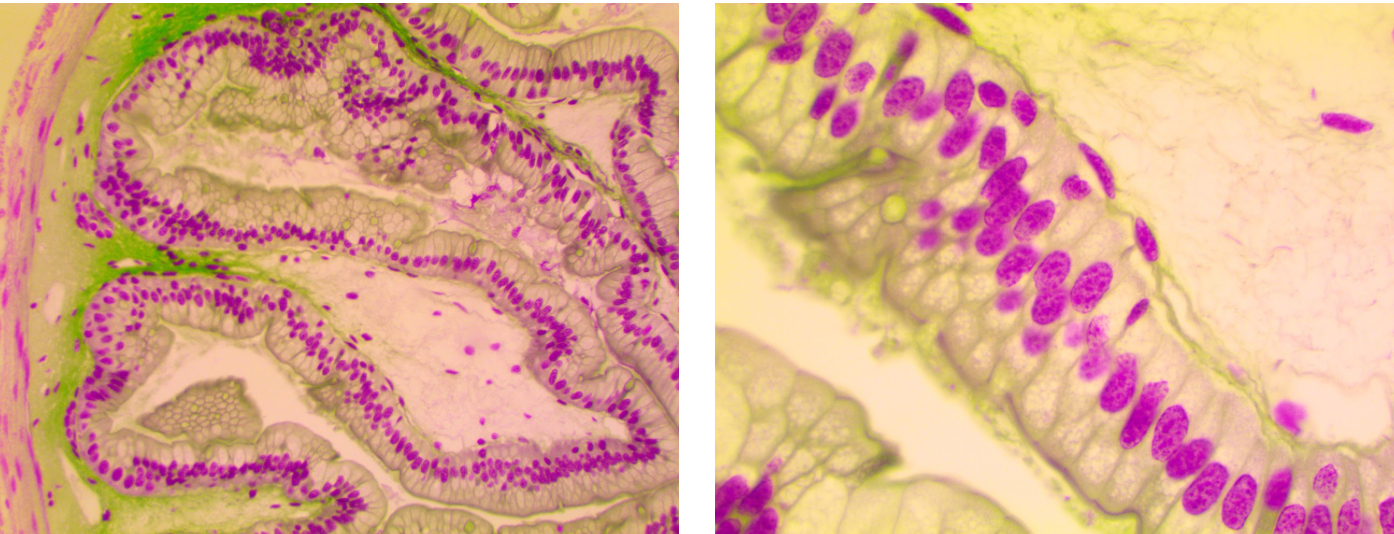 <p>Simple columnar epithelium</p>