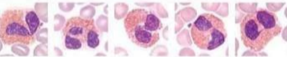 <p>What lymphocyte?</p>