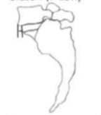 <p>identify grade</p>