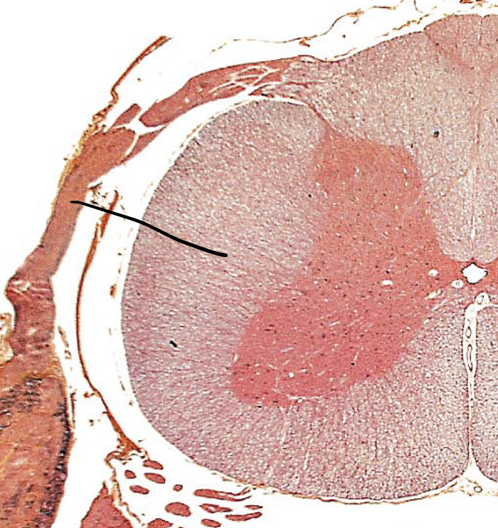 <p><span>middle of white column</span></p>