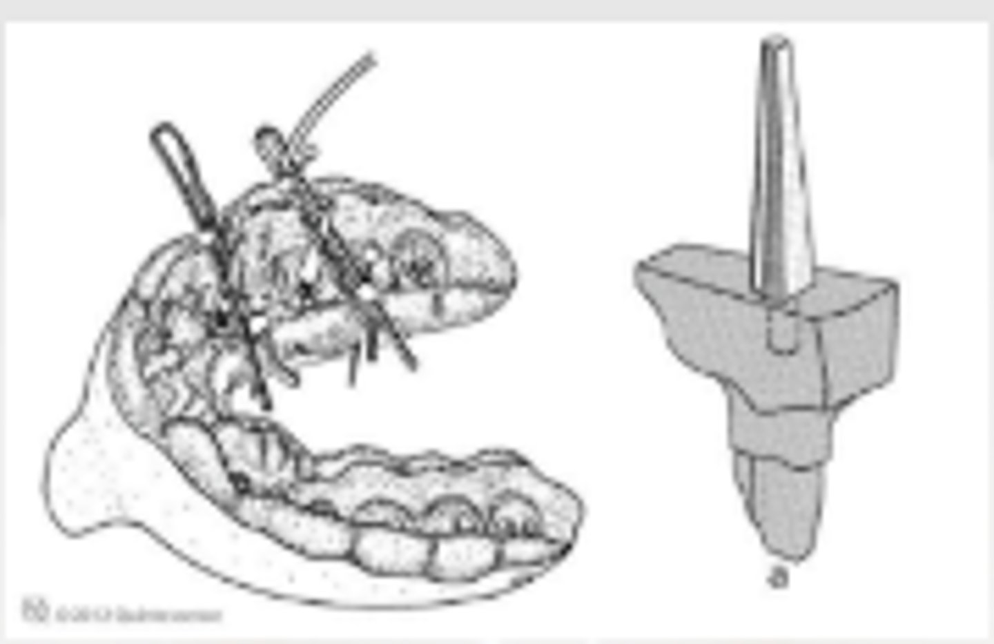 <p>ID the technique</p>