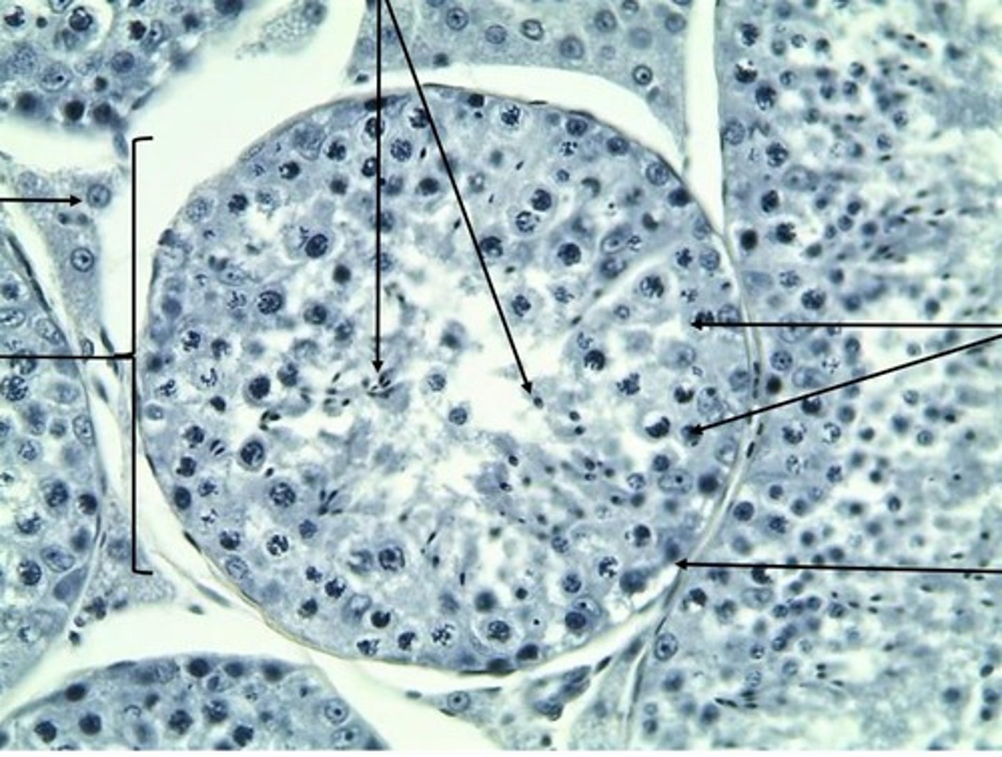 <p>thin membrane surrounding the tubule</p>