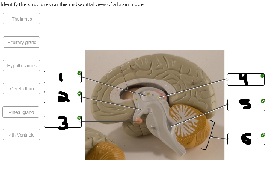 <p>whats labeled #1</p>