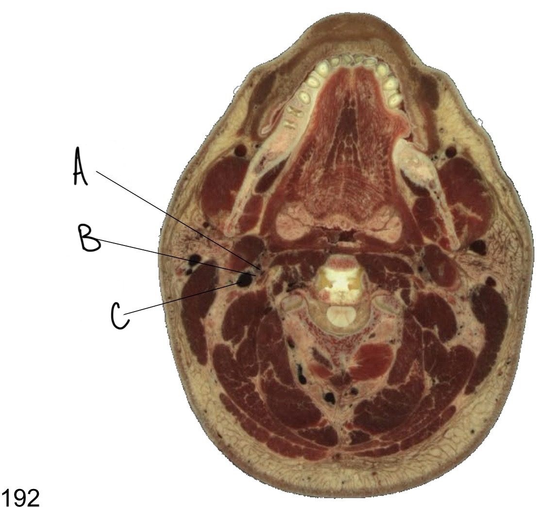 <p>what structure is labeled C?</p>