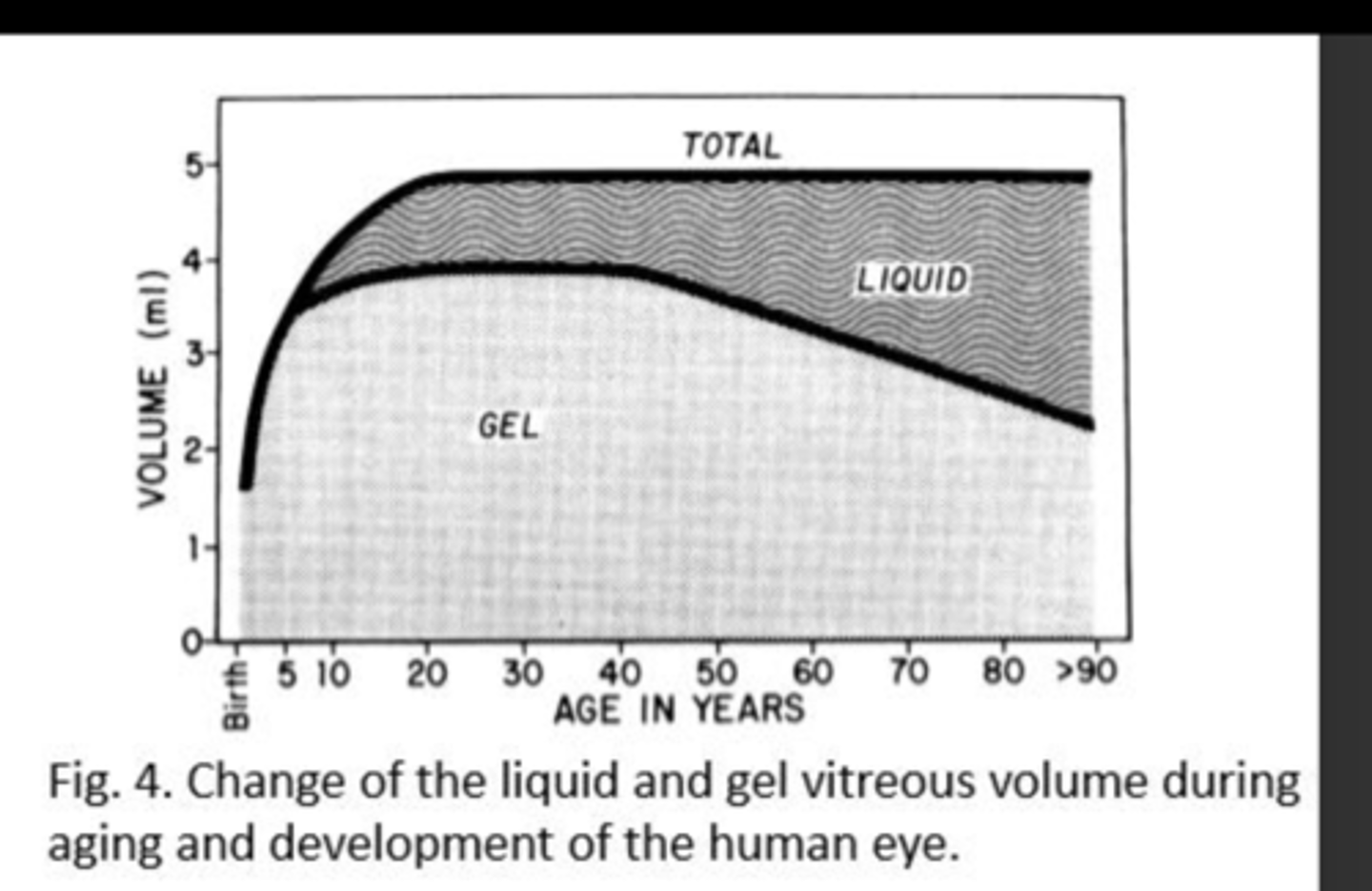 <p>Becomes more liquid in the center, forming:</p><p>1) pockets of fluid</p><p>2) aggregation of collagen fibrils - floaters</p>