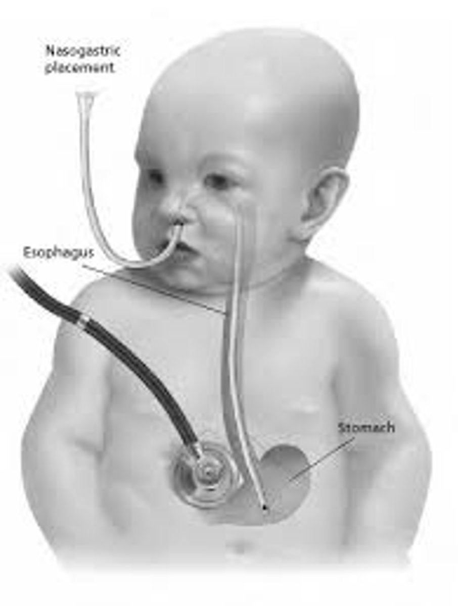 <p>a. Infection</p><p>b. Aspiration</p><p>c. Weight loss</p><p>d. Feeding intolerance</p><p>Infection because bacterial counts in milk may become too high. Aspiration because they may be left unattended at times during a feeding. Weight loss because fats tend to adhere to the tubing during the continuous feeding. Pg 632</p>