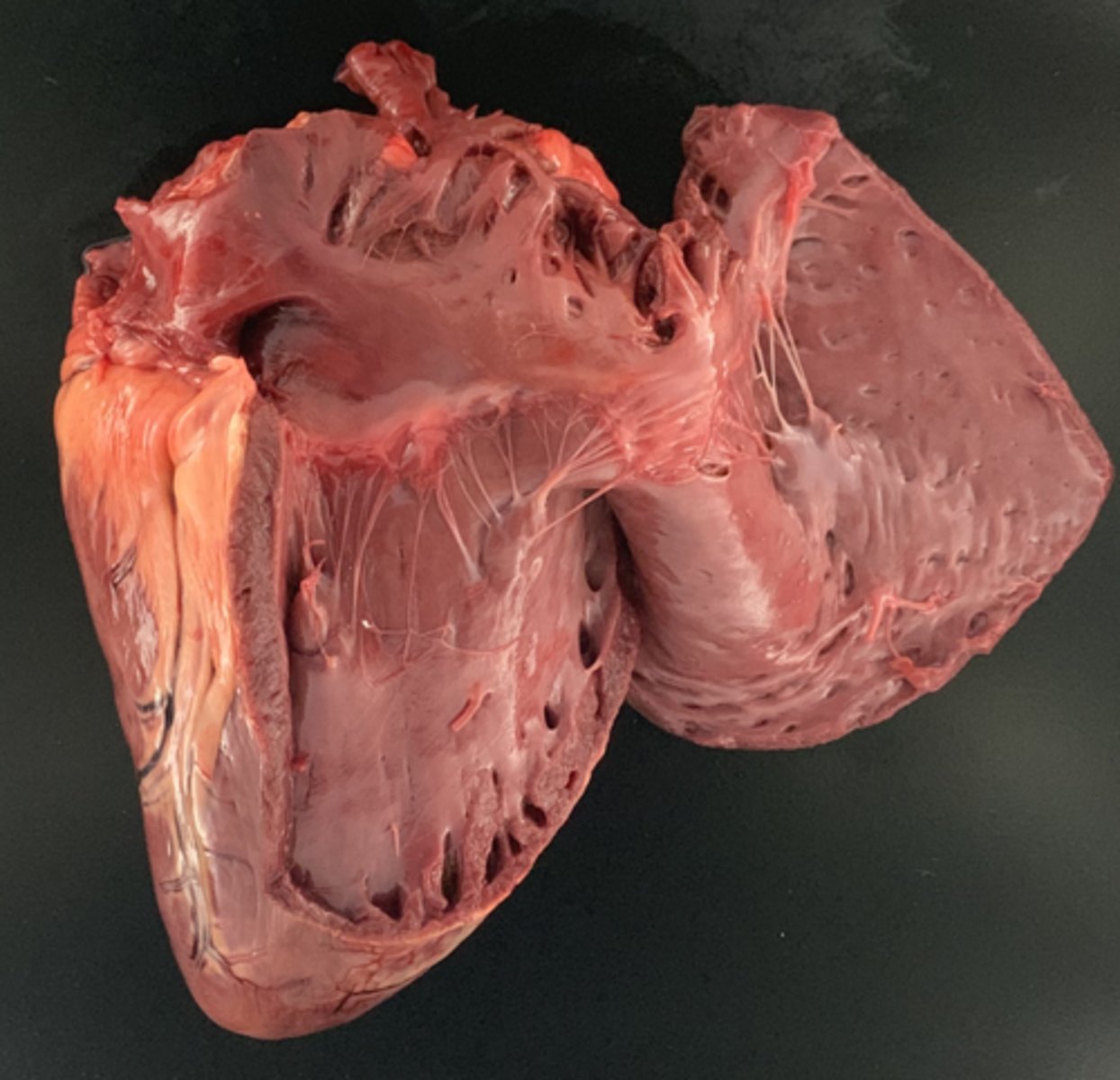 <p>From the right atrium, where do we look next?</p>