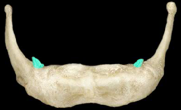 Non-seasonal structures formed from the frontal bone, covered by a keratin sheath. Non-branched on both males and females.
e.g. on cows