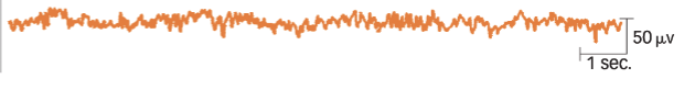 <p>Beta Waves - Faster &amp; less synchronized than alpha waves</p>