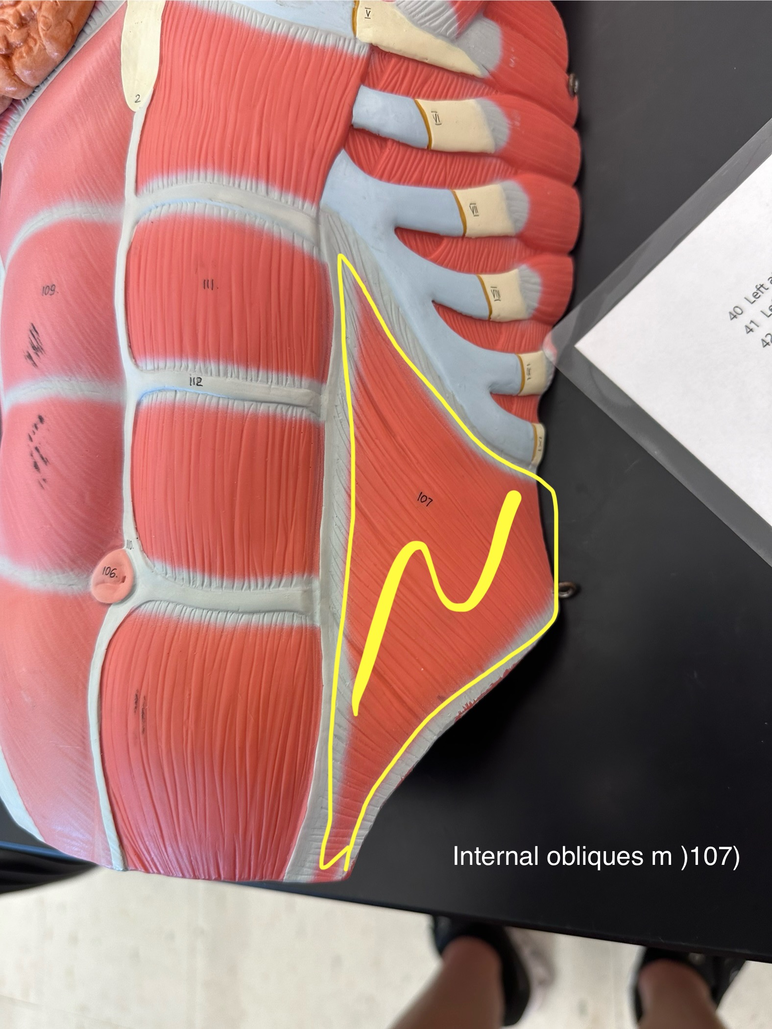 <p>Internal obliques muscle</p>