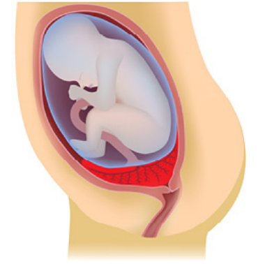 <p>What kind of placenta is shown?</p>